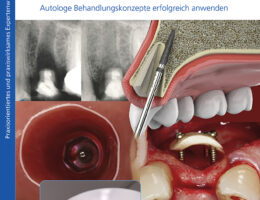 Coverbild Regenerative Zahnheilkunde (Die Bildrechte liegen bei dem Verfasser der Mitteilung.)