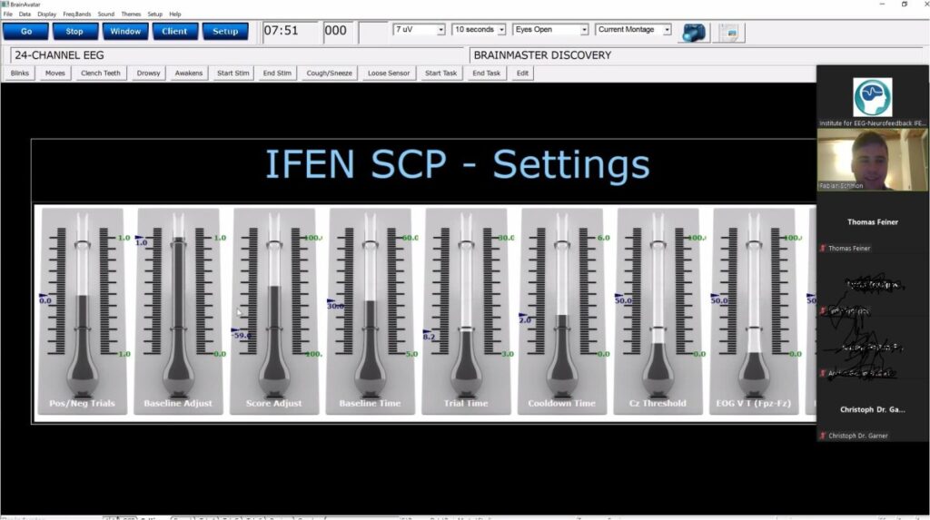 SCP Neurofeedback-Protokoll IFEN (© Institut für EEG-Neurofeedback)